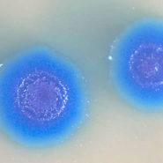Mycoplasma Contamination in Cell Cultures