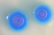Mycoplasma Contamination in Cell Cultures