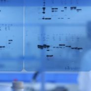 Western Blot Guide